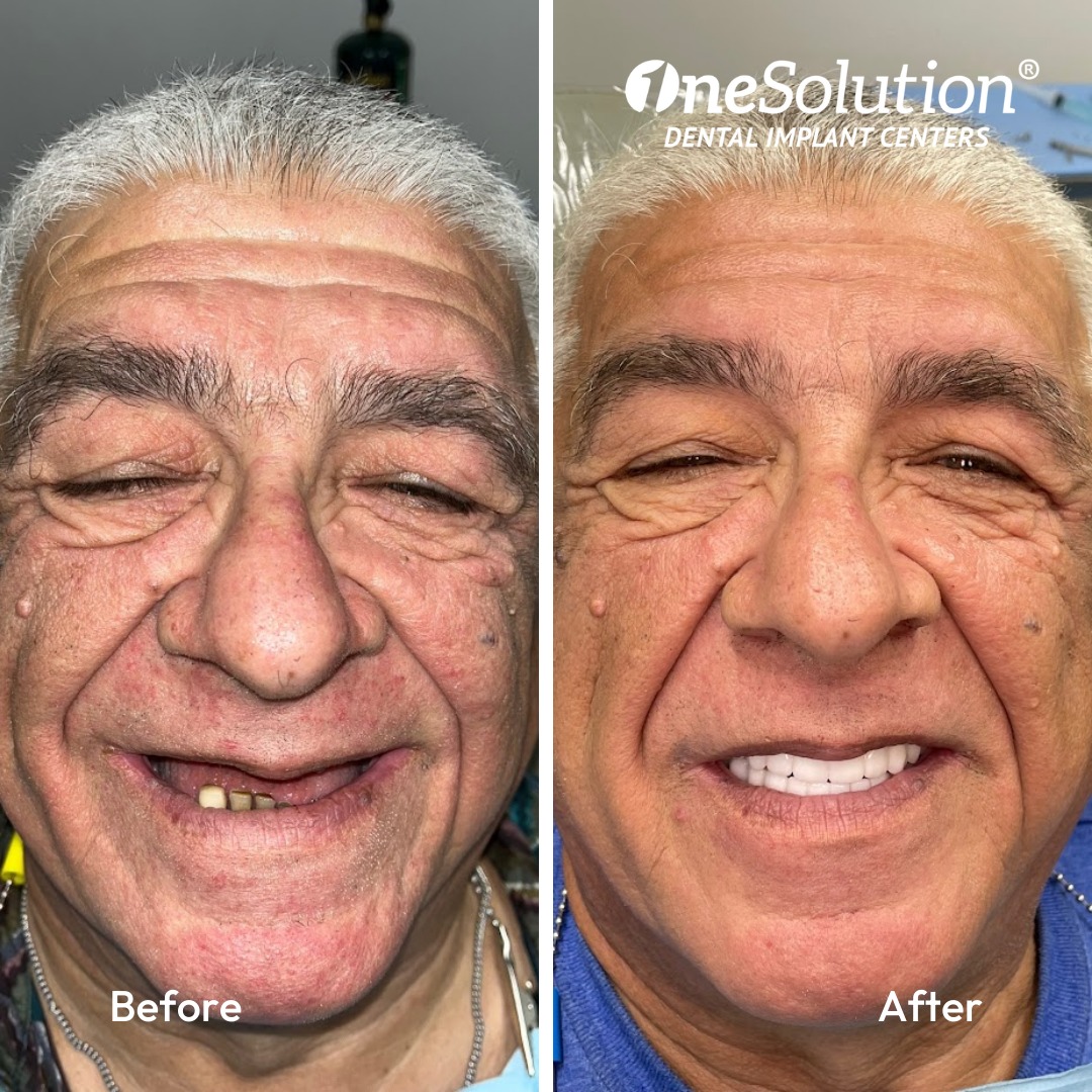 Before & After Success