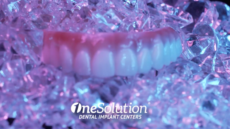 Full Mouth Zirconia Dental Implants